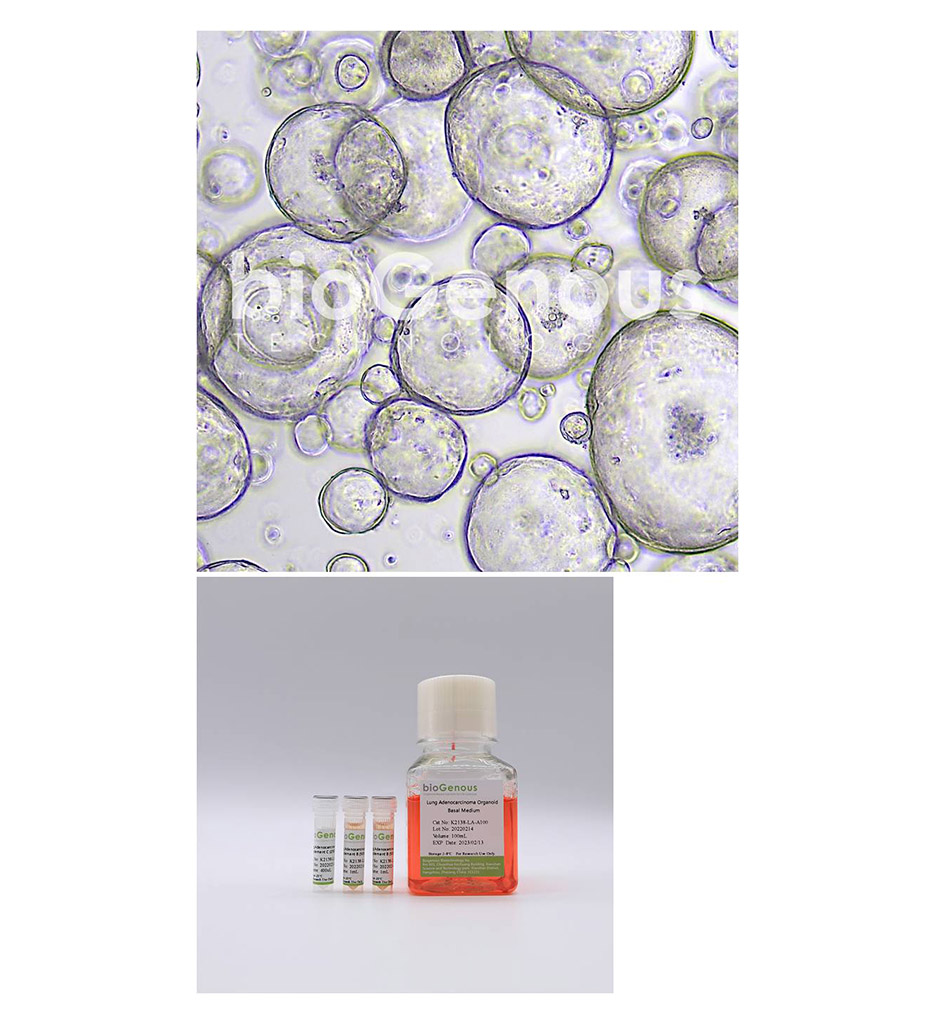 Lung Adenocarcinoma Organoid Kit肺腺癌
