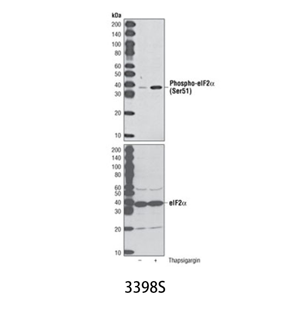 Phospho-eIF2α (Ser51) (D9G8) XP Rabbit mAb