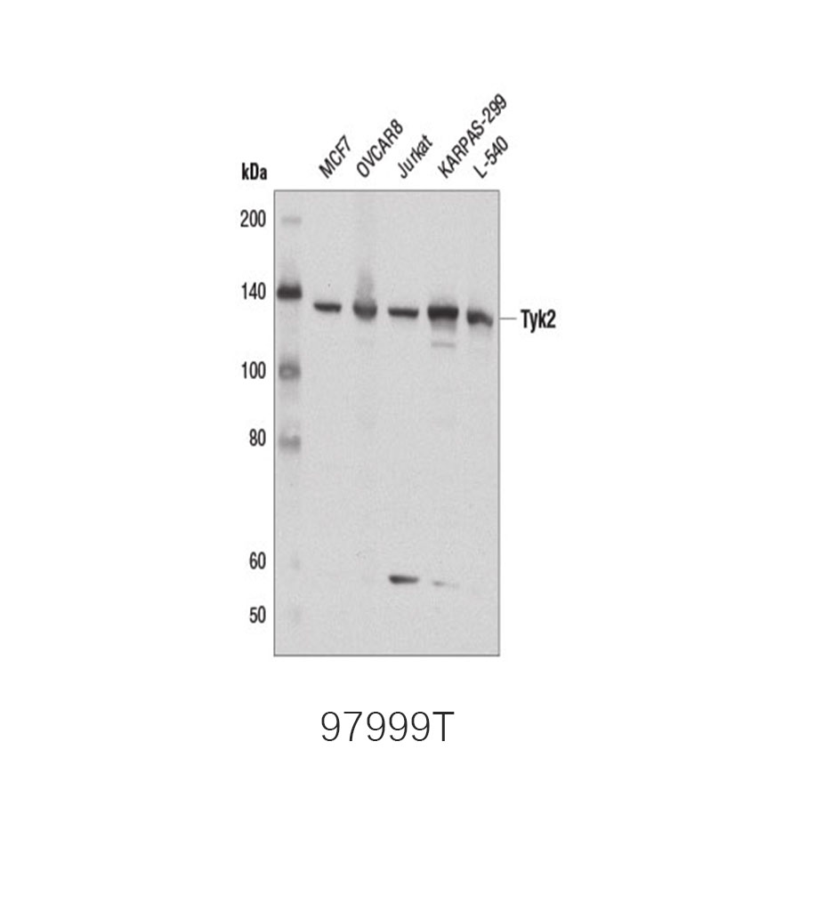 Phospho-Jak Family Antibody Sampler Kit