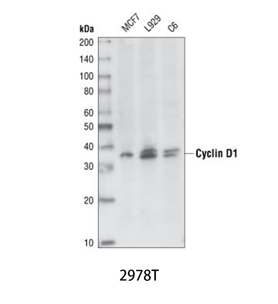 Cyclin D1 (92G2) Rabbit mAb