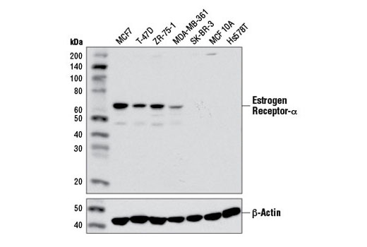 Estrogen Receptor α (D6R2W) Rabbit mAb