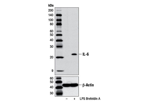 IL-6 (D5W4V) XP Rabbit mAb (Mouse Specific)
