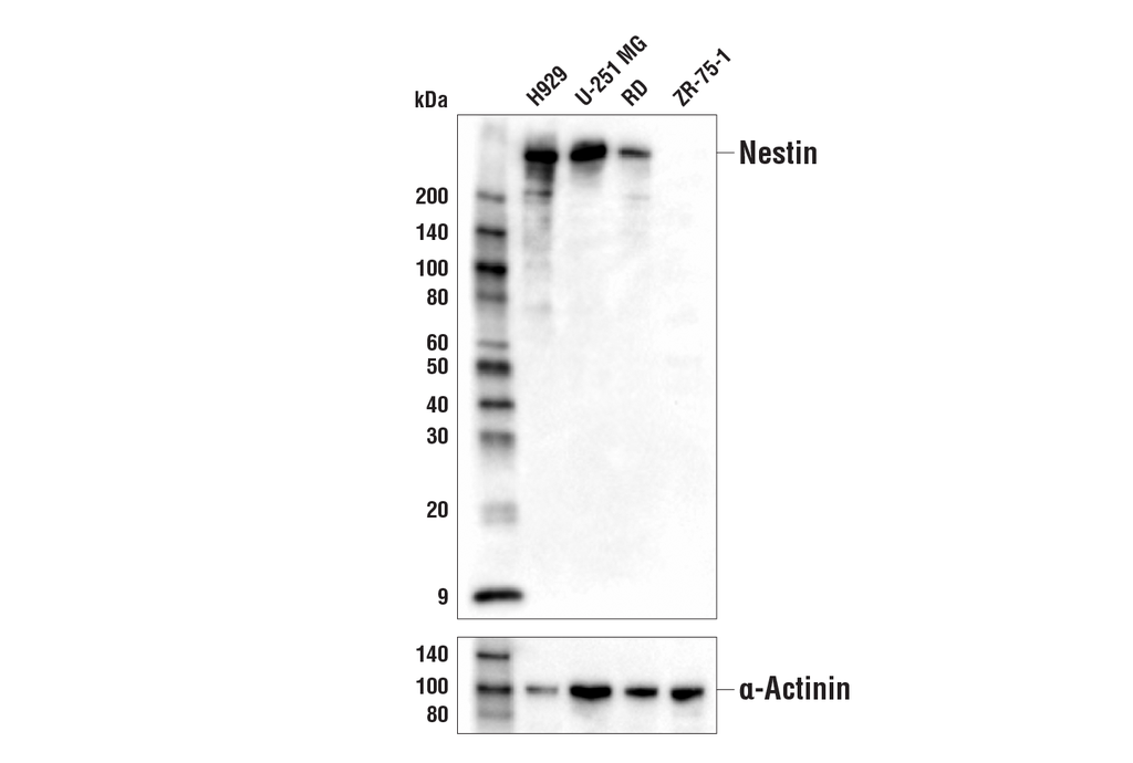 Nestin (10C2) Mouse mAb