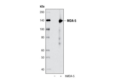MDA-5 (D74E4) Rabbit mAb