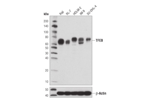 TFEB (D2O7D) Rabbit mAb