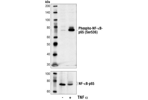 Phospho-NF-κB p65 (Ser536) (7F1) Mouse mAb