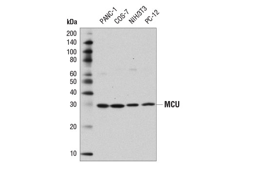 MCU (D2Z3B) Rabbit mAb