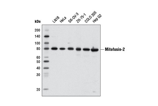 Mitofusin-2 (D1E9) Rabbit mAb