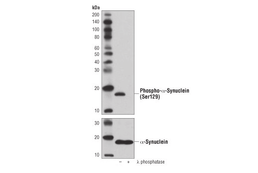 Phospho-α-Synuclein (Ser129) (D1R1R) Rabbit mAb