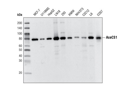 AceCS1 (D19C6) Rabbit mAb