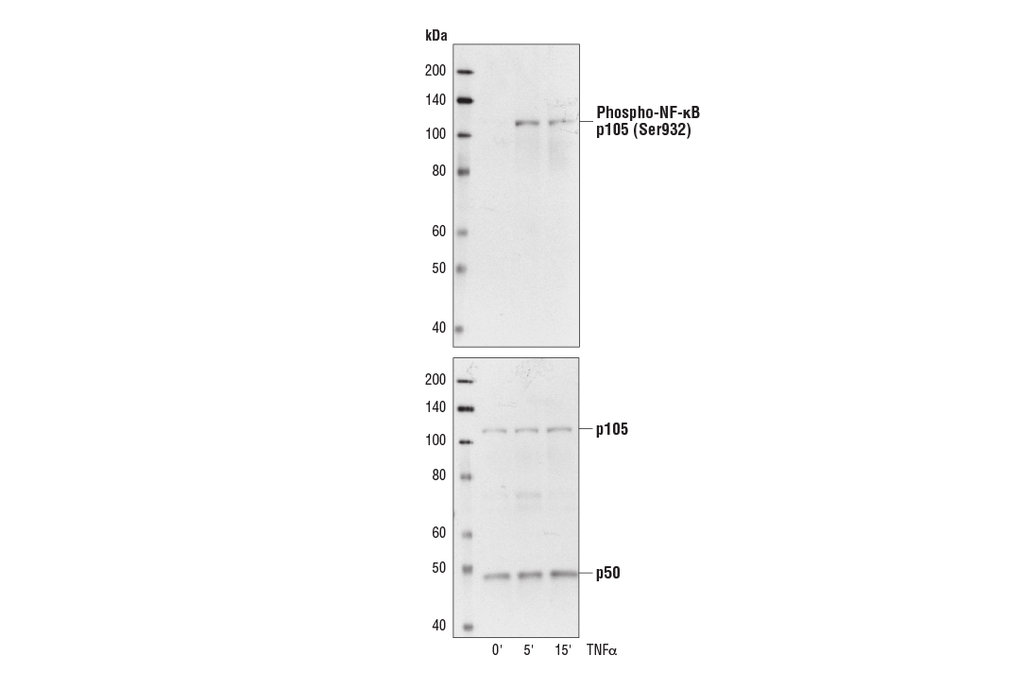 Phospho-NF-κB p105 (Ser933) (18E6) Rabbit mAb