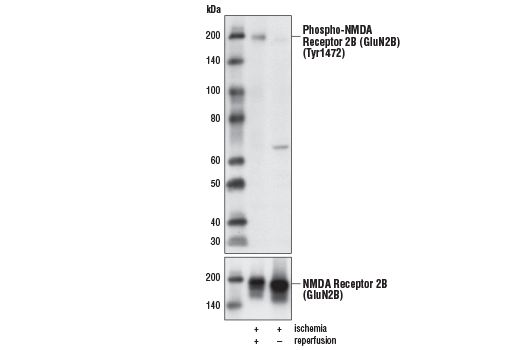 Phospho-NMDA Receptor 2B (GluN2B) (Tyr1472) Antibody