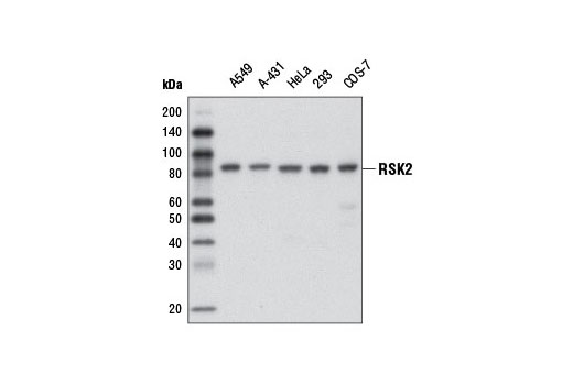 RSK2 (D21B2) XP Rabbit mAb