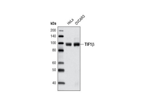 KAP-1 (C42G12) Rabbit mAb