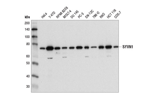 SYVN1 (D3O2A) Rabbit mAb