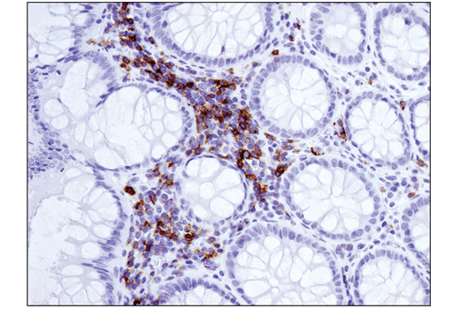 ICOS (D1K2T) Rabbit mAb (IHC Specific)