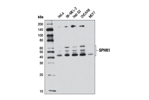 SPHK1 (D1H1L) Rabbit mAb