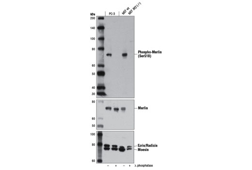 Phospho-Merlin (Ser518) (D5A4I) Rabbit mAb