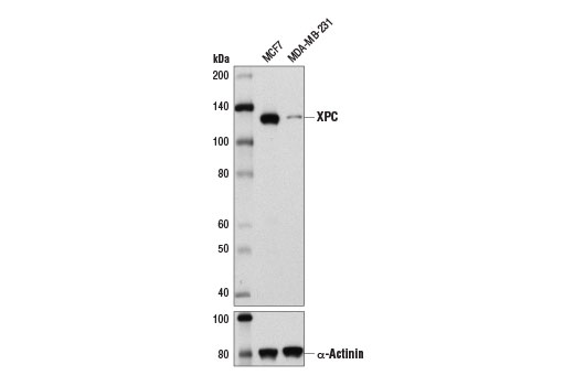 XPC (D1M5Y) Rabbit mAb