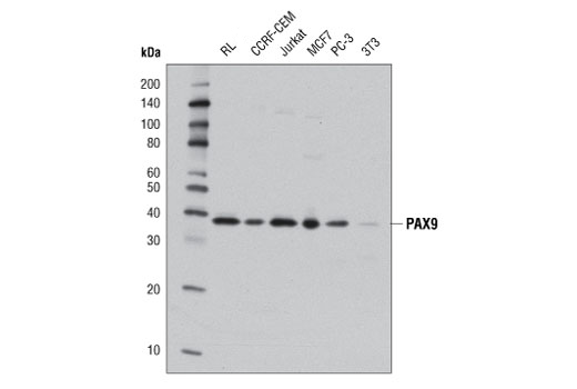 PAX9 (D9F1N) Rabbit mAb