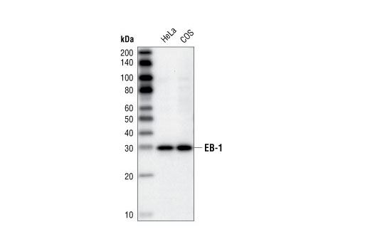 EB-1 (1A11/4) Mouse mAb