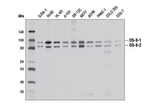 OS-9 (D8P4G) Rabbit mAb