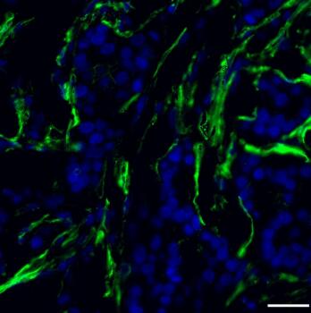 CD138 Antibody, anti-human, FITC