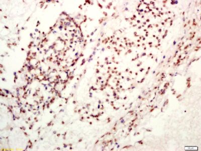 Ten-eleven转运基因1蛋白抗体