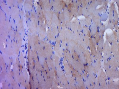 磷酸化表皮生长因子受体抗体