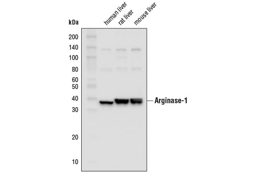 Arginase-1 (D4E3M) XP Rabbit mAb (HRP Conjugate)