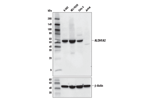 ALDH1A2 Antibody