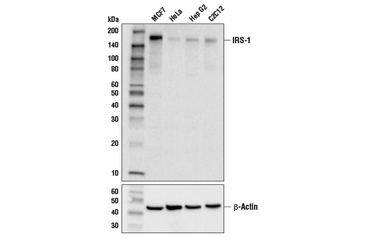 IRS-1 (D5T8J) Rabbit mAb