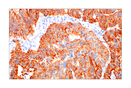 Pan-Keratin (AE1/AE3) Mouse mAb