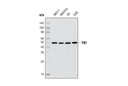 YB1 (D299) Antibody