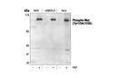 Phospho-Met (Tyr1234/1235) Antibody