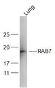 RAS癌基因相关蛋白RAB7抗体