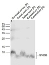 S100B蛋白单克隆抗体