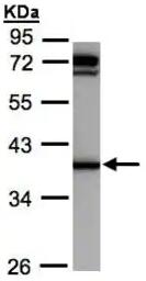 Anti-AKR1C1抗体