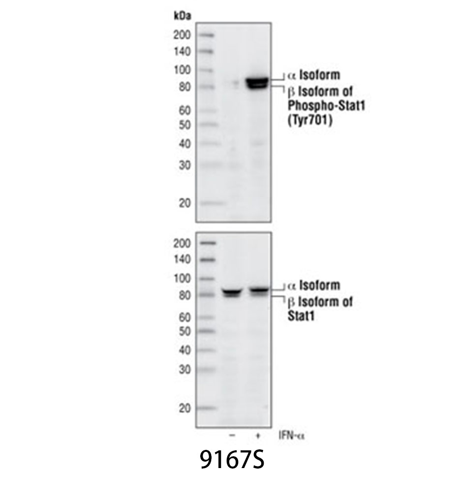 Phospho-Stat1 (Tyr701) (58D6) Rabbit mAb