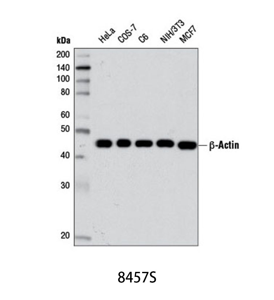 β-Actin (D6A8) Rabbit mAb