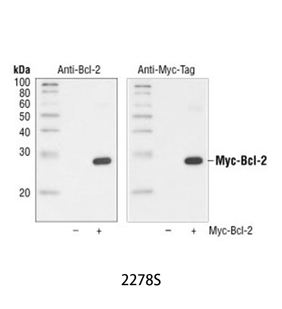 Myc-Tag (71D10) Rabbit mAb