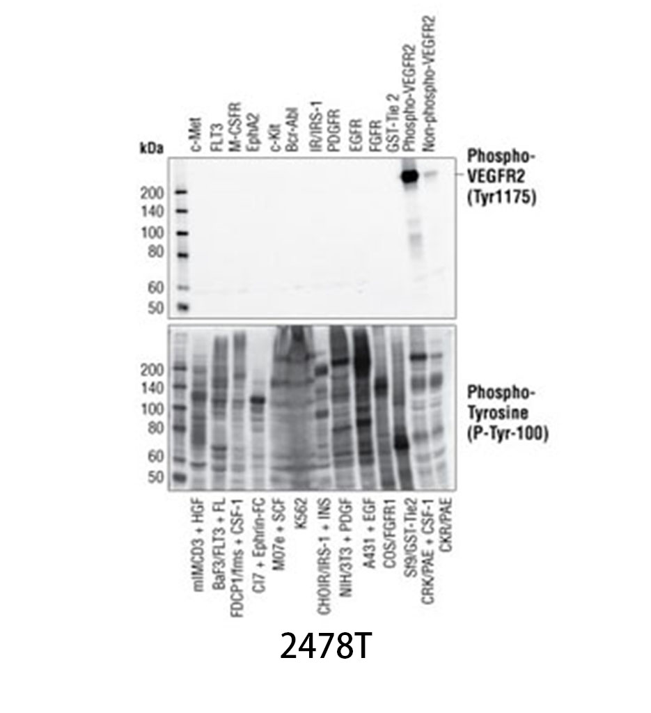 Phospho-VEGF Receptor 2 (Tyr1175) (19A10) Rabbit mAb