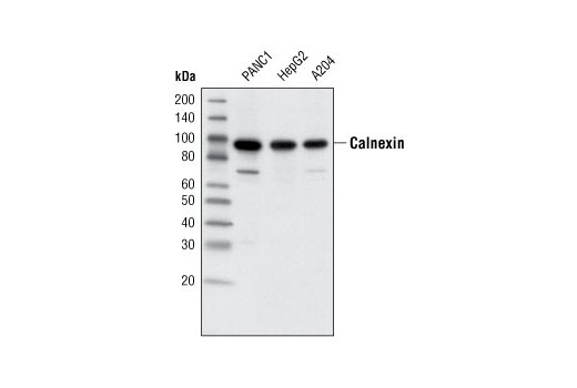 ER Stress Antibody Sampler Kit