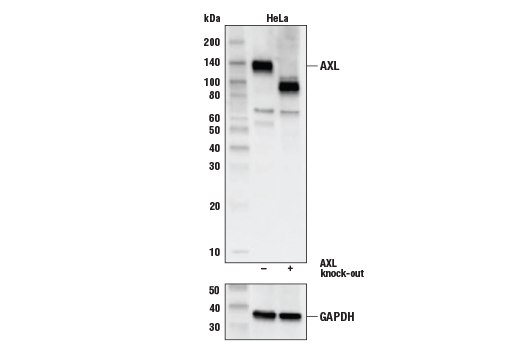 Axl (C89E7) Rabbit mAb
