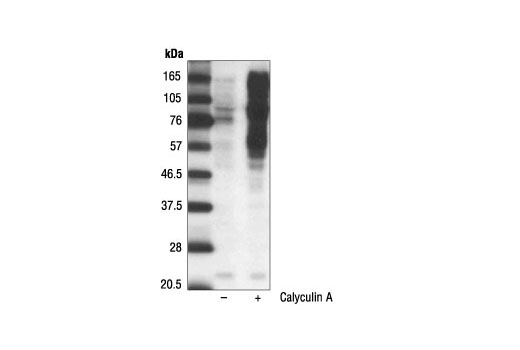 Phospho-(Ser/Thr) Phe Antibody