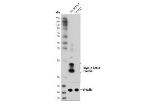 Myelin Basic Protein (D8X4Q) XP Rabbit mAb
