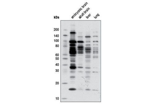 Mono-Methyl Arginine [mme-R] MultiMab Rabbit mAb mix