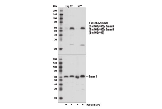 Phospho-Smad1 (Ser463/465)/ Smad5 (Ser463/465)/ Smad9 (Ser465/467) (D5B10) Rabbit mAb