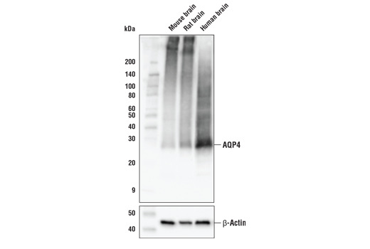 AQP4 (D1F8E) XP Rabbit mAb