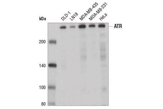 ATR (E1S3S) Rabbit mAb